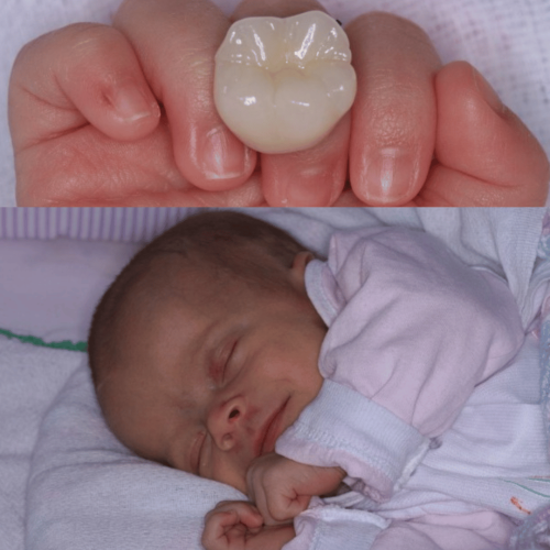 Wanderley - Lentes diretas (45)